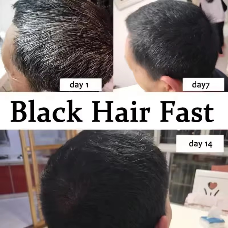 Serum Perawatan Rambut Putih A - Hair Care Ginseng ulasan dan harga