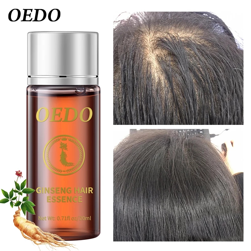 20ML Ginseng Hair Growth Essen - Hair Care Ginseng ulasan dan harga