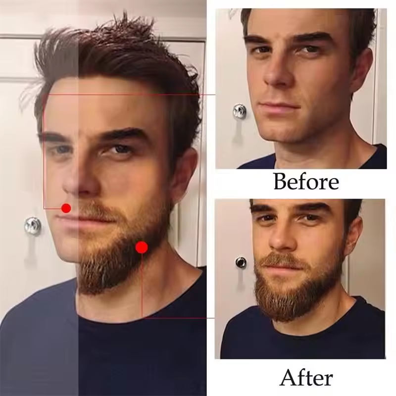 Minyak Esens Pertumbuhan Jengg - Hair Care Essence Oil Spray ulasan dan harga