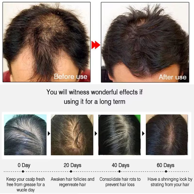 Semprotan Penumbuh Rambut Jahe - Hair Care Natural ulasan dan harga